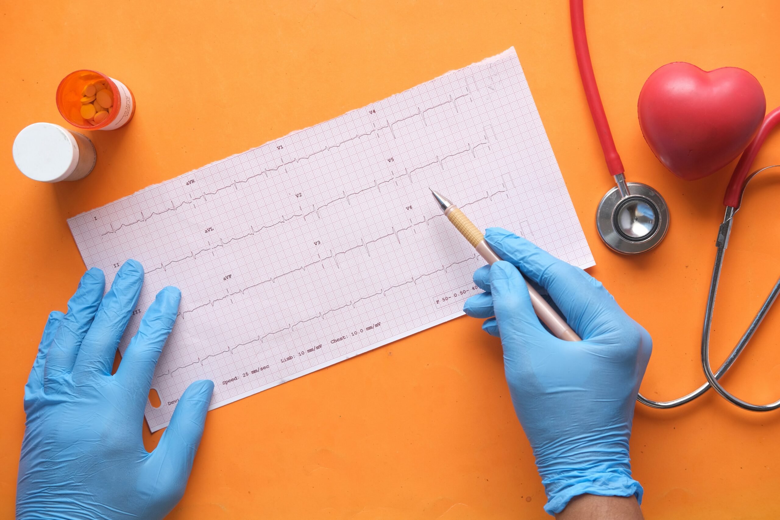 Hands with blue gloves, holding a pen over a chart